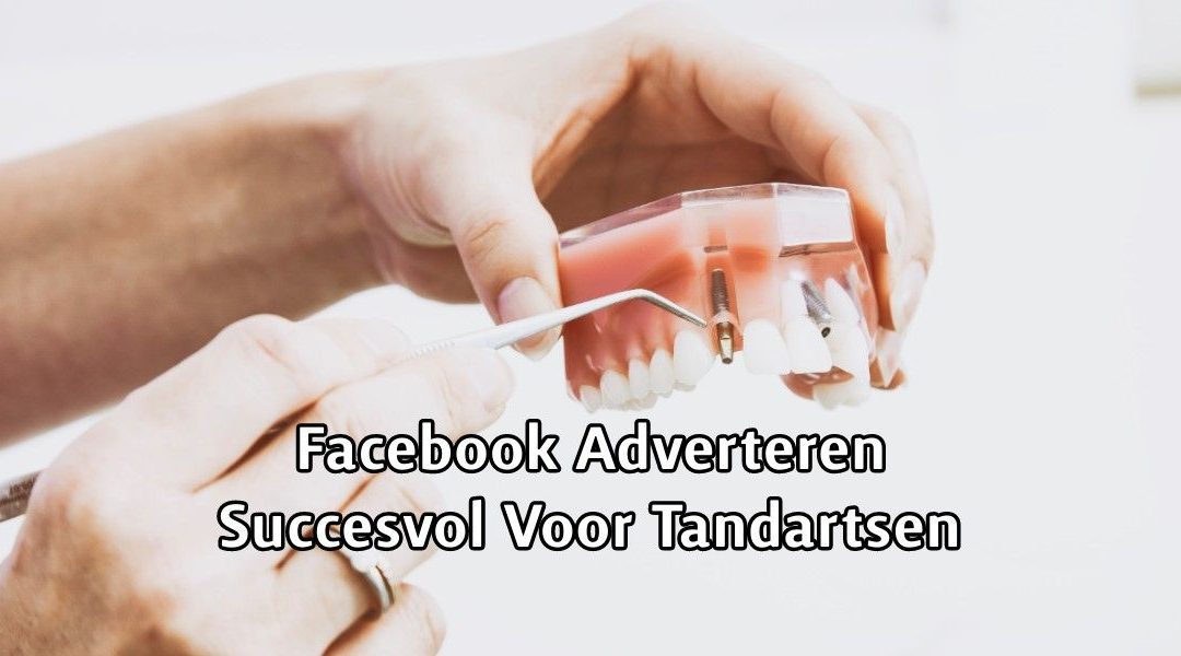 Facebook Adverteren Succesvol Voor Tandartsen